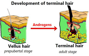 Development Of Terminal Hair