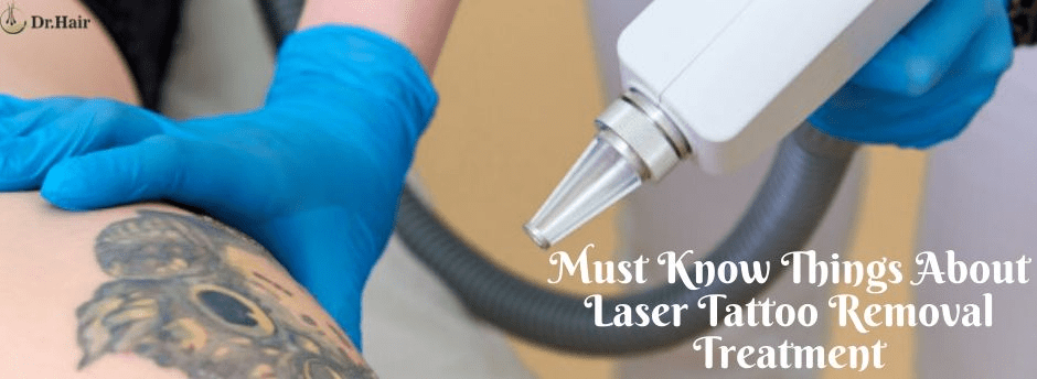 You are currently viewing Must Know Things About Laser Tattoo Removal Treatment