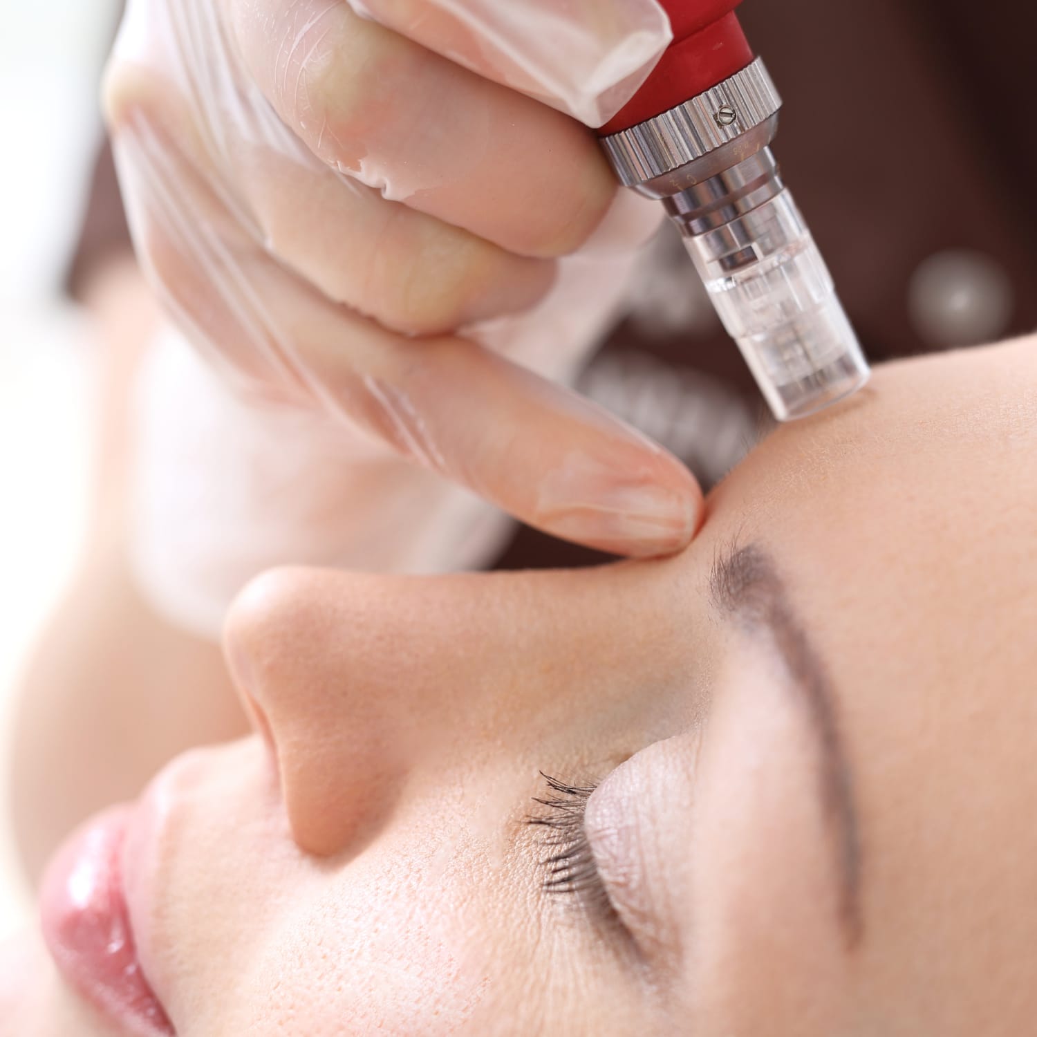 microneedling raleigh nc