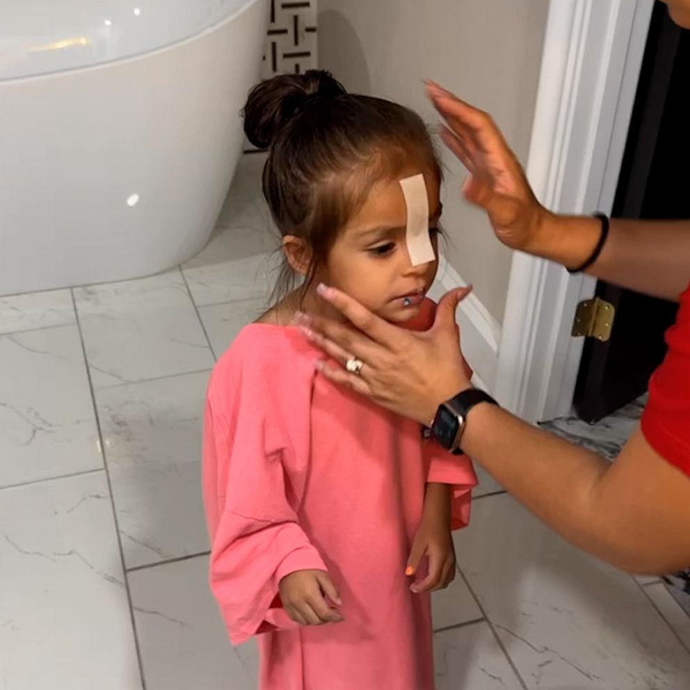 VIDEO: Mom defends waxing 3-year-old’s eyebrows, experts weigh in