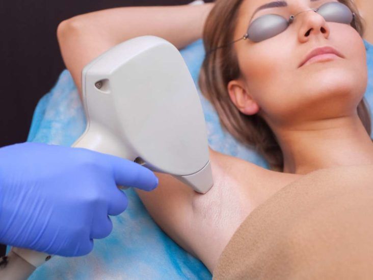 Laser Hair Removal