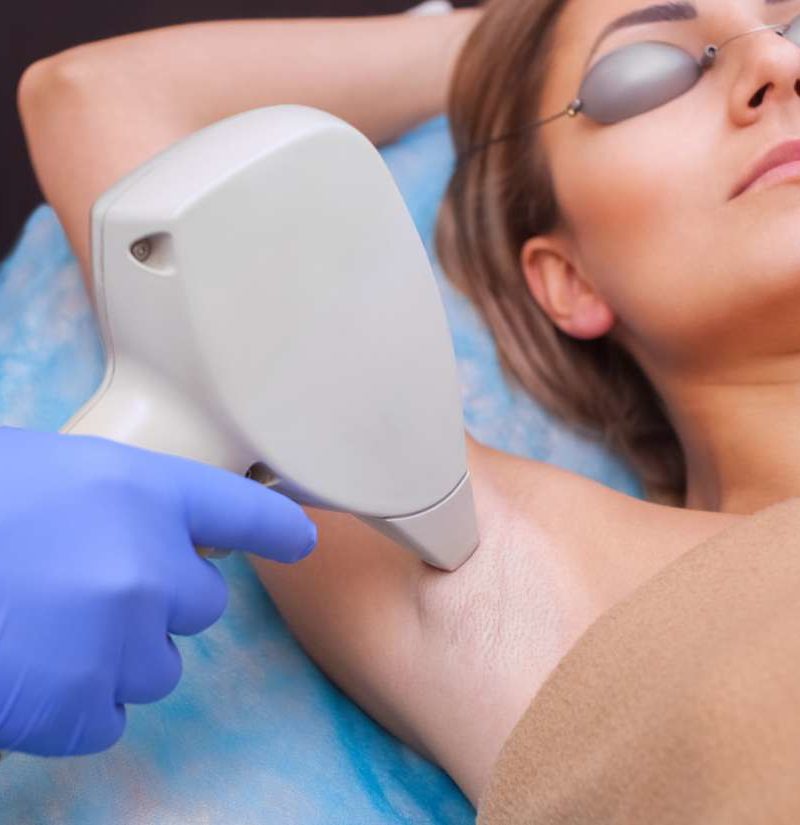 Laser Hair Removal Atlanta