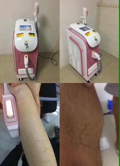 NEW hot sale 360 Magneto-optic hair removal IPL laser tattoos removal beauty machine salon spa use DHL free shipping