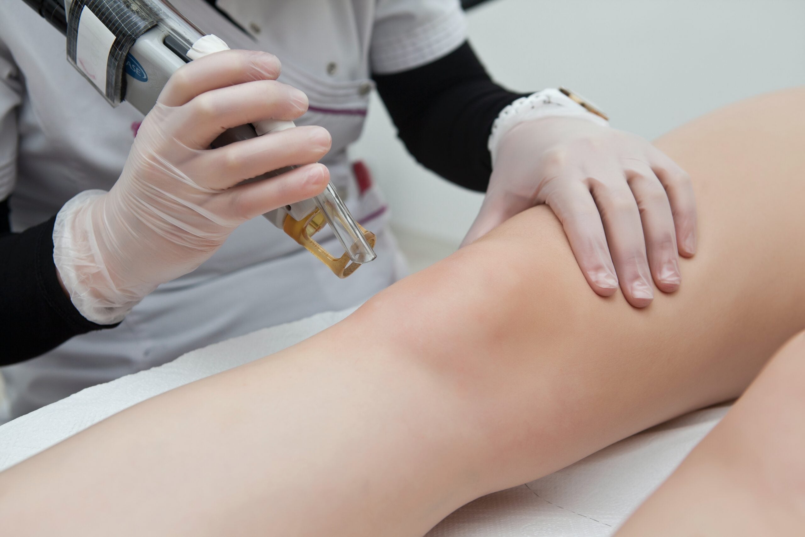 6 Pros and Cons of Laser Hair Removal: Is It For You?