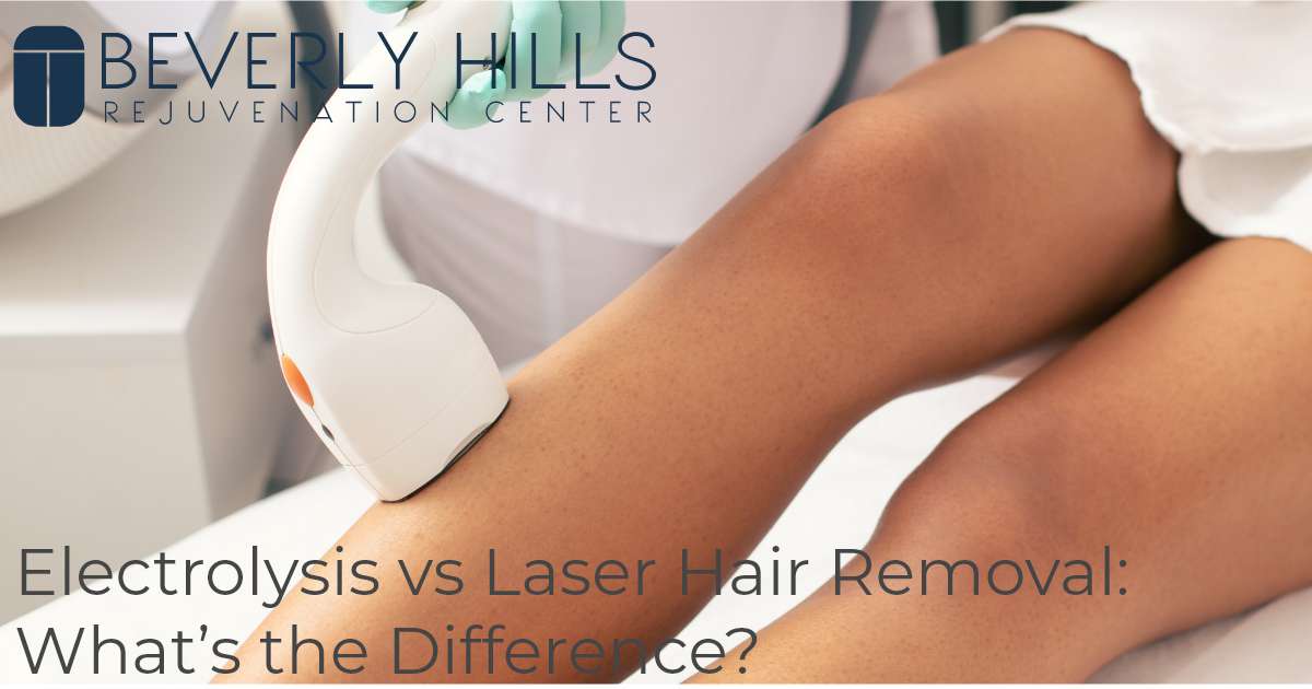 Electrolysis vs Laser Hair Removal: What’s the Difference?