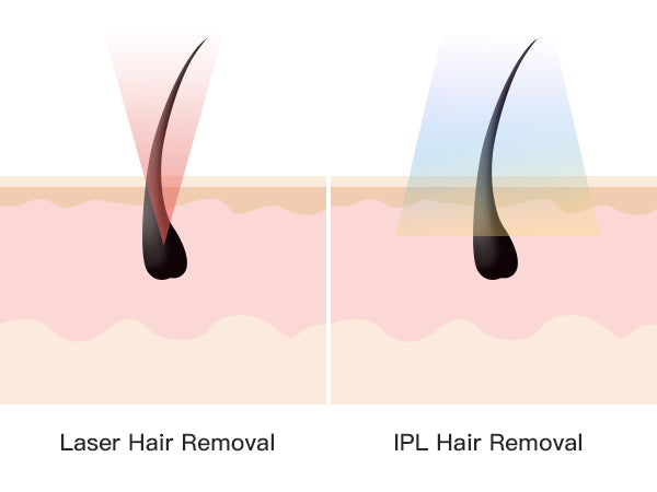 Laser Hair Removal Near Me