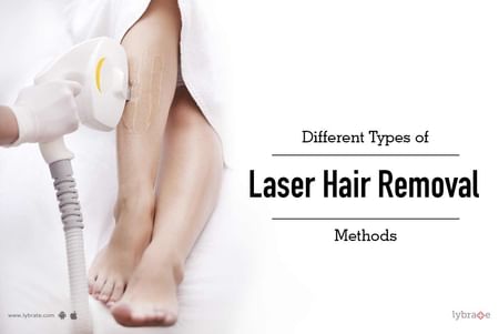 Laser Hair Removal