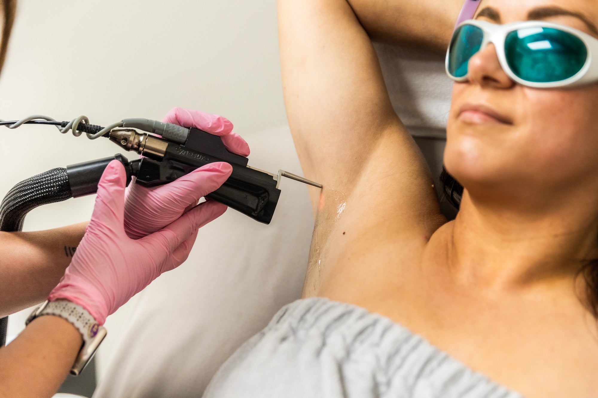 The Best Strategy To Use For East Brunswick Laser Hair Removal