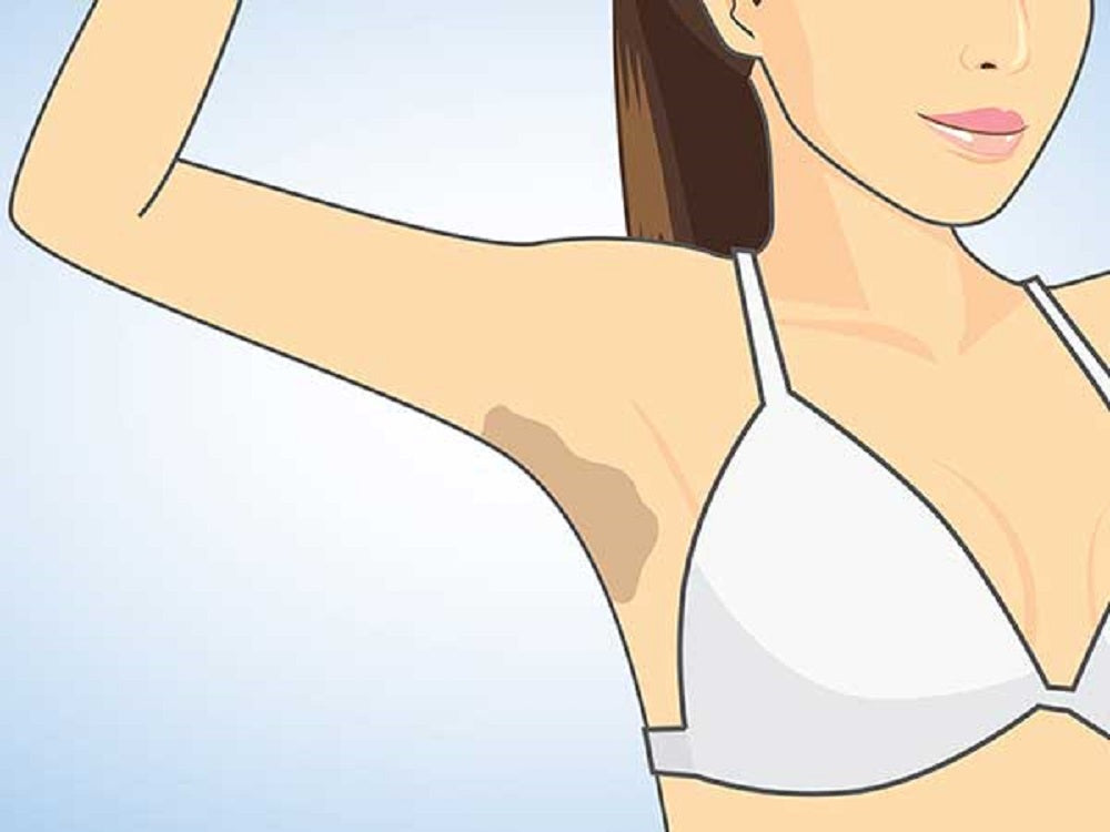 Dark Armpits: How to Prevent and Safely Lighten Underarms