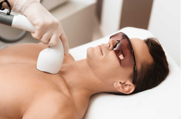 Laser Hair Removal: A Guide to Smooth, Hair-Free Skin