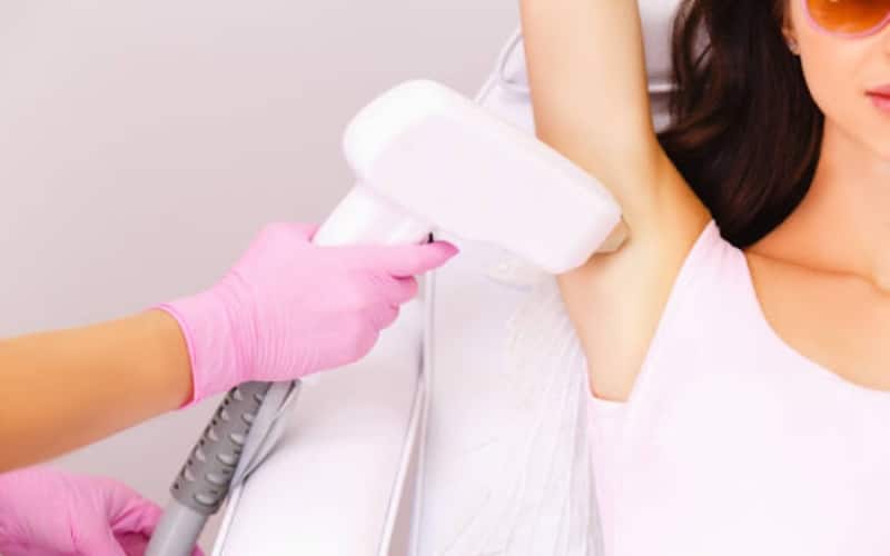 Best Body Hair Removal Services in Singapore – Find the Right Option for You