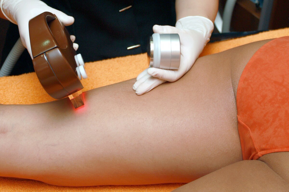 Brazilian Hair Removal Singapore: Is it Bad to get a Brazilian Laser Hair Removal?