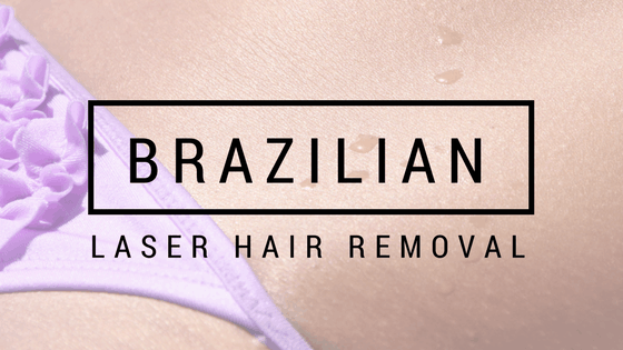 Brazilian Laser Hair Removal