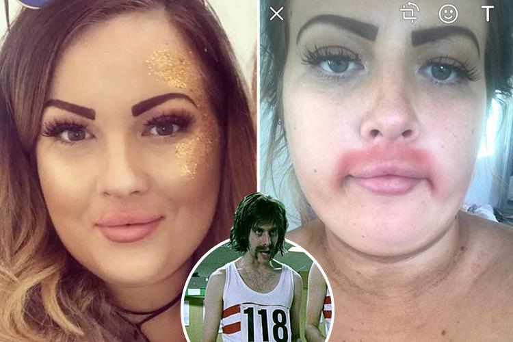 Mum’s mates compare her to blokes off 118 118 ads after hair removal cream burns bright red moustache on her face