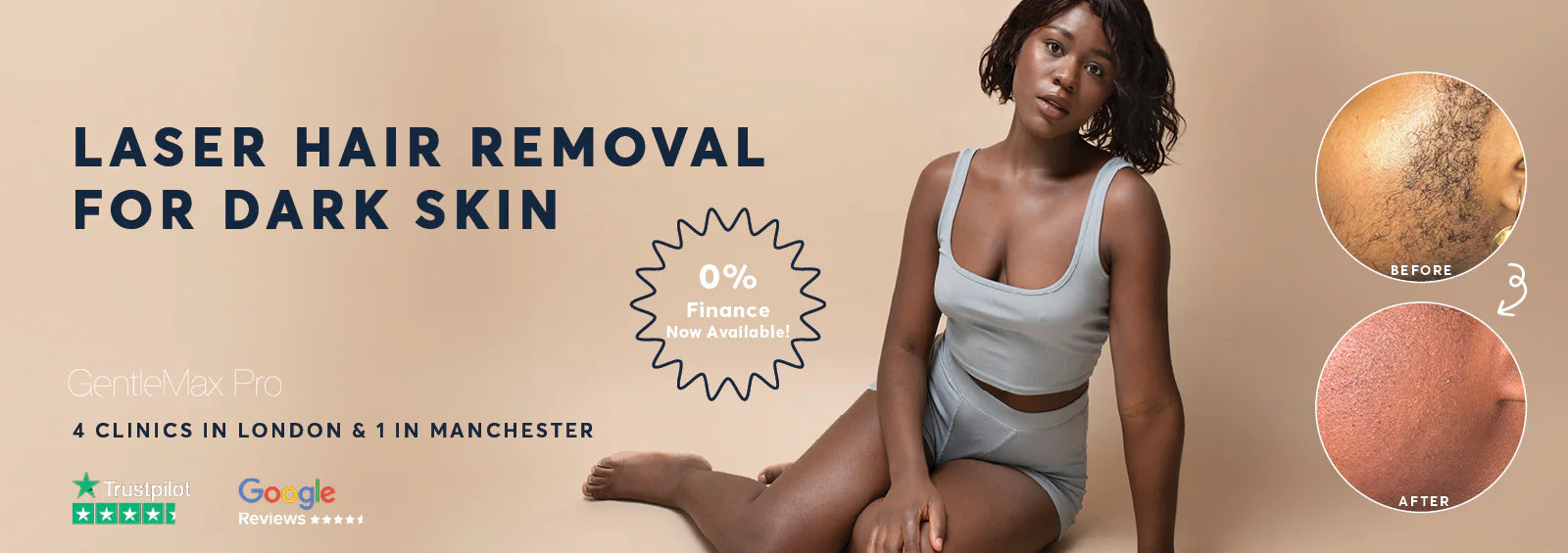 Laser Hair Removal Dark Skin London