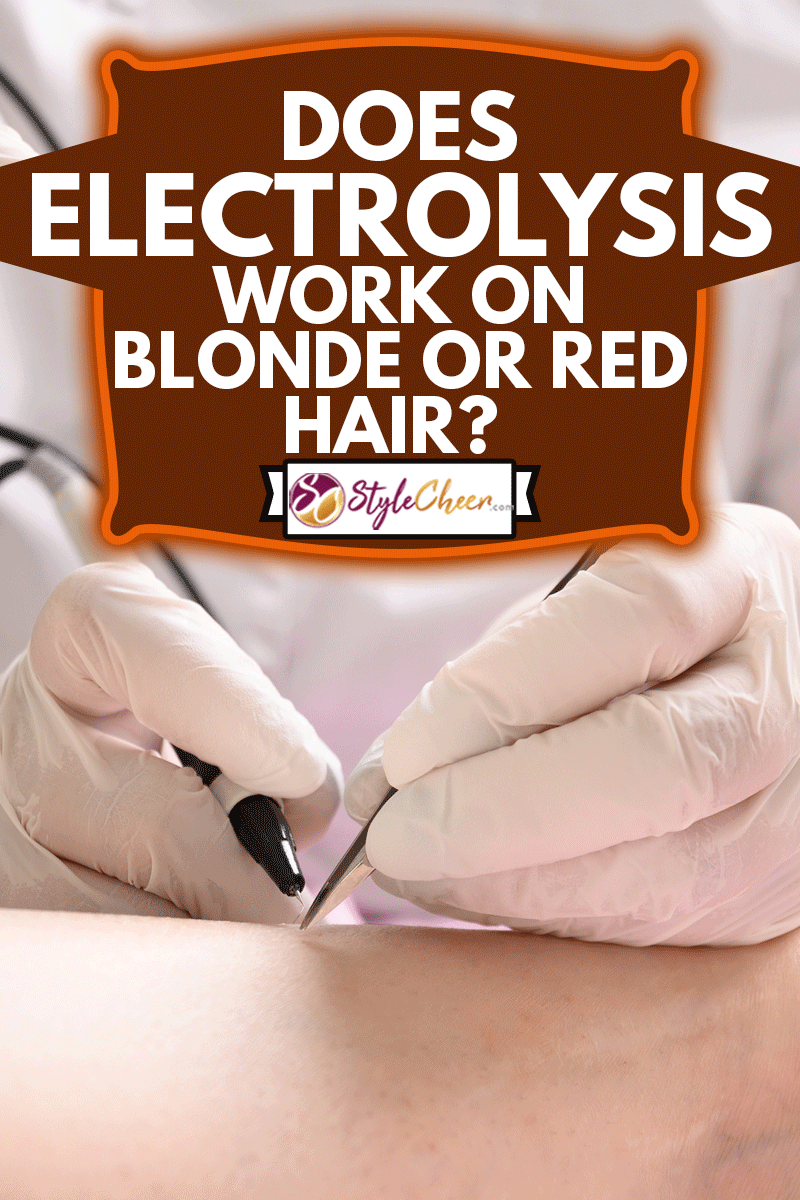 Removal hair from womans legs by electro epilation method, Does Electrolysis Work On Blonde Or Red Hair?