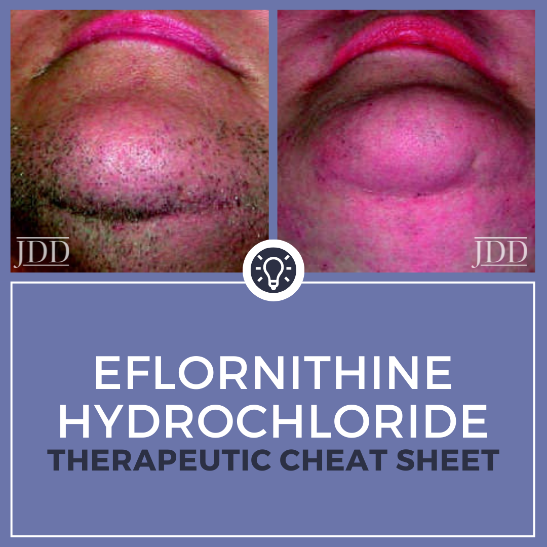 Eflornithine Hydrochloride Therapeutic Cheat Sheet