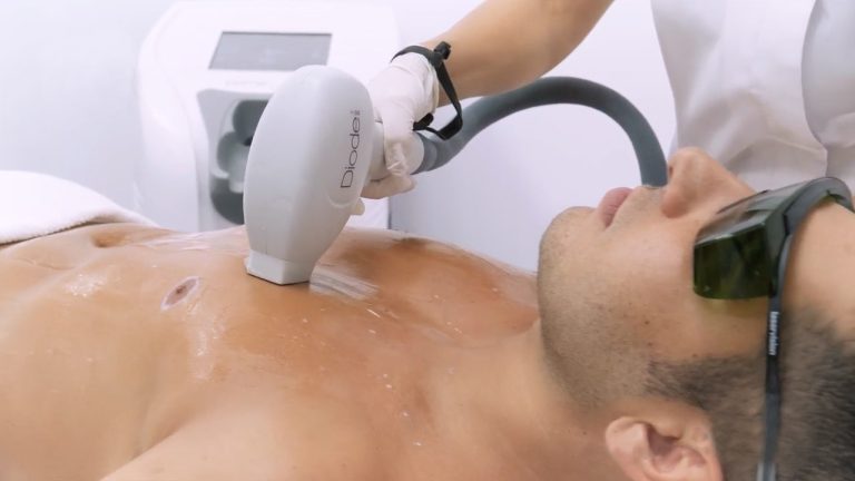 The smart Trick of Laser Hair Removal Raleigh Nc That Nobody is Talking About