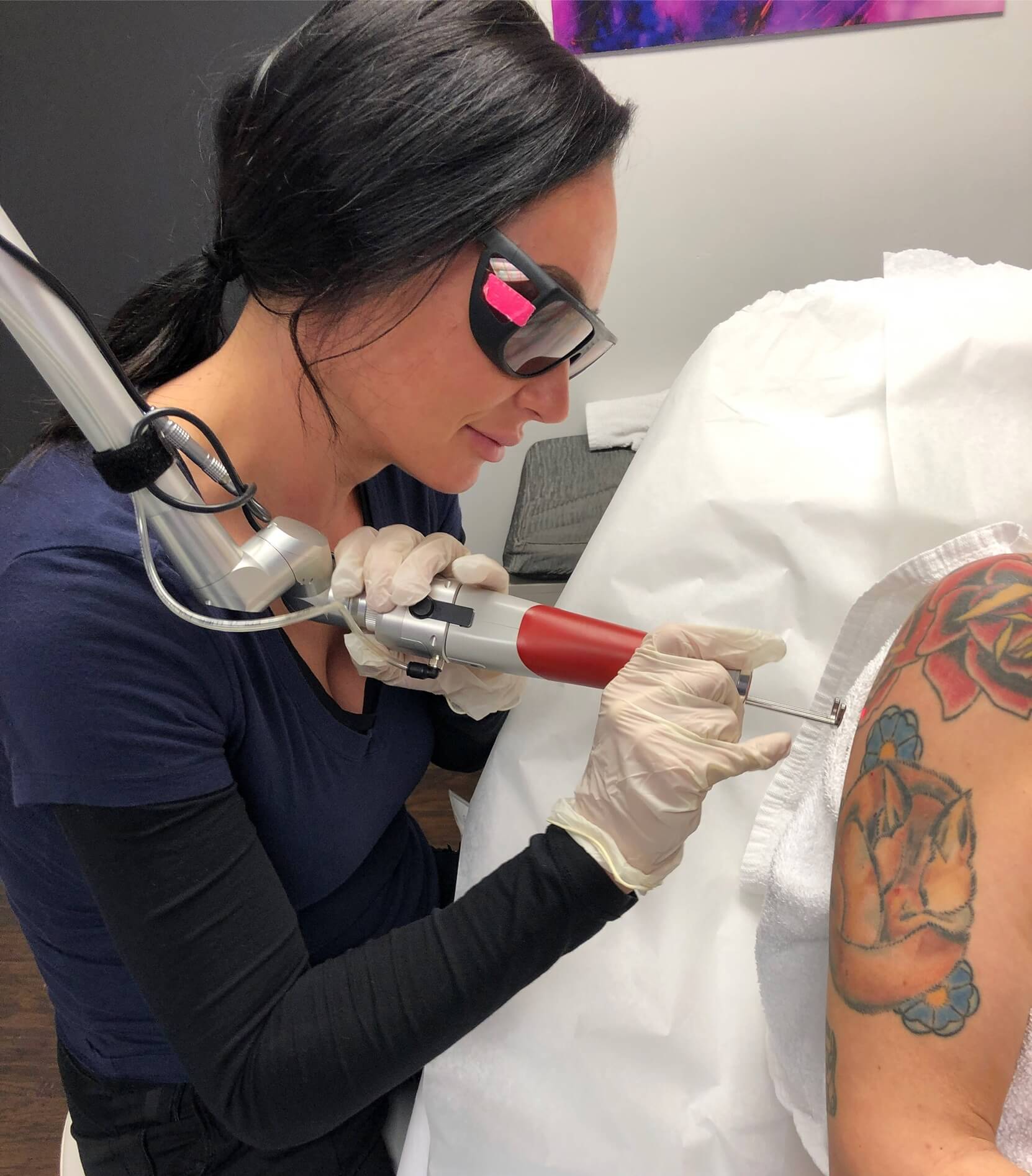 Laser Tattoo Removal Business | Everything you need to know