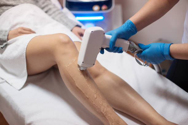 ipl vs laser - Laser Hair Removal Toronto