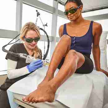 laser hair removal