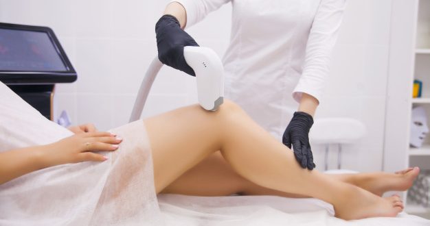 Laser hair removal in Chandigarh