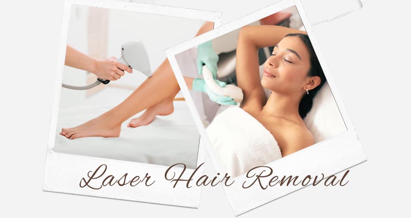 Laser Hair Removal Cost