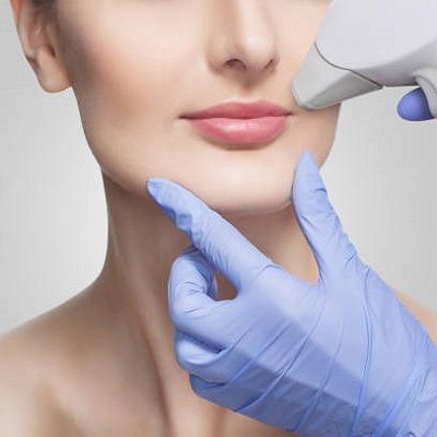 Laser Hair Removal for Face