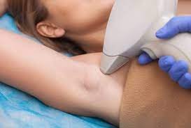 Laser Hair Removal in Jaipur