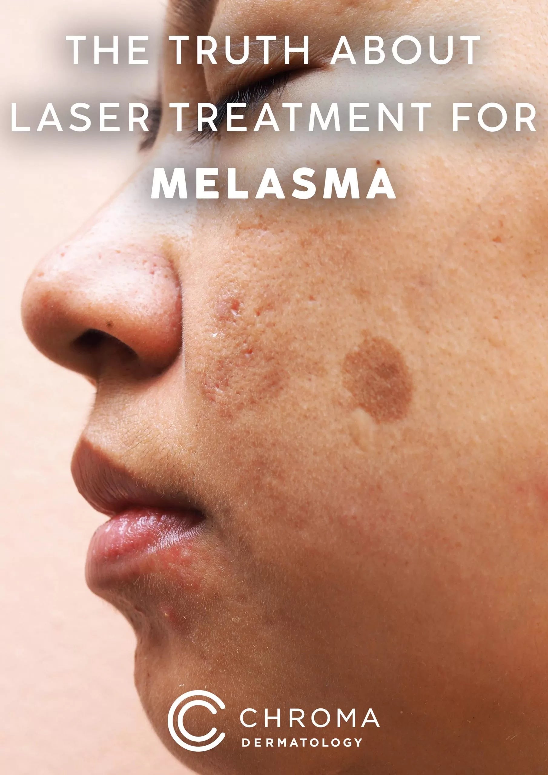 Laser Skin Treatments