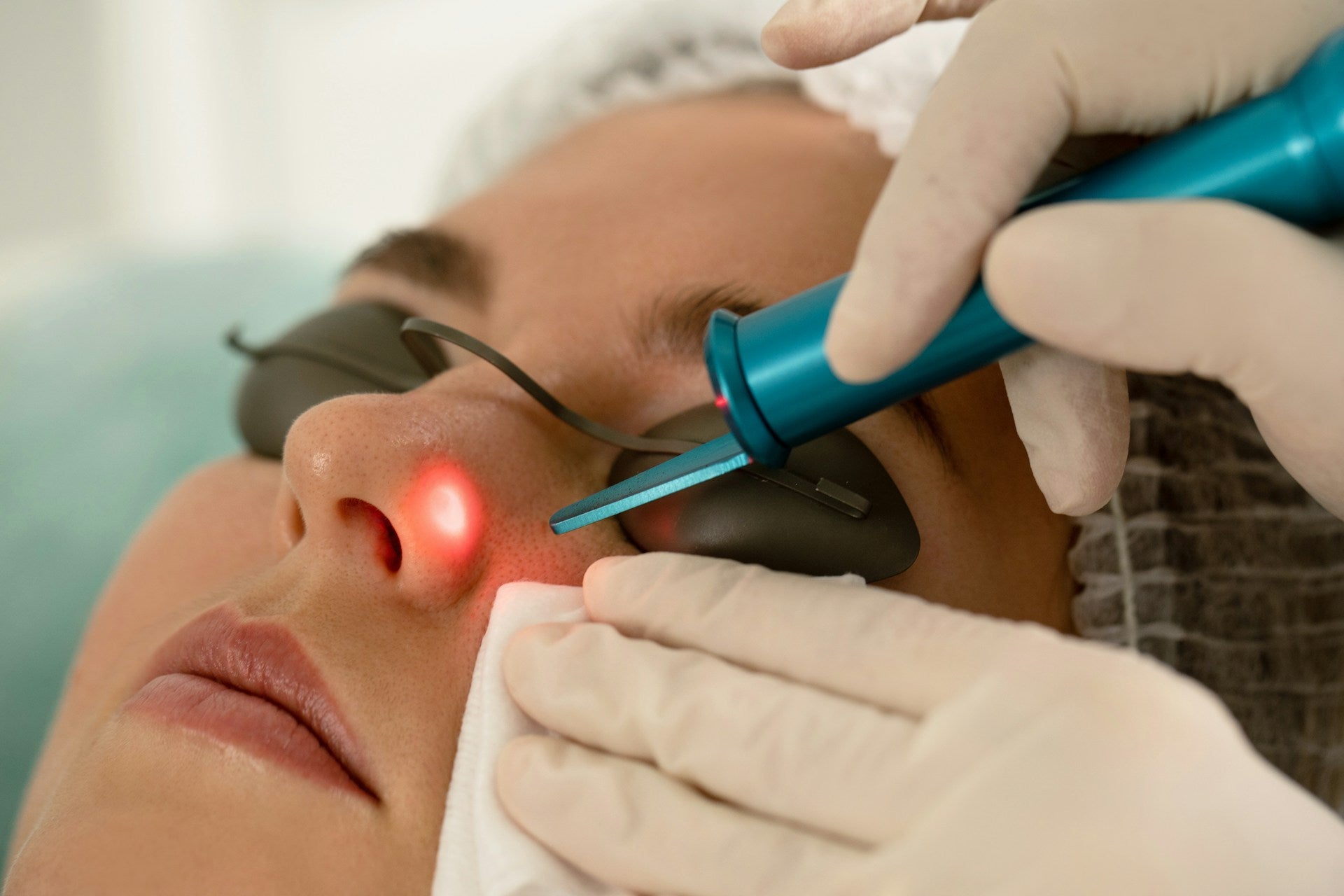 Laser Treatments