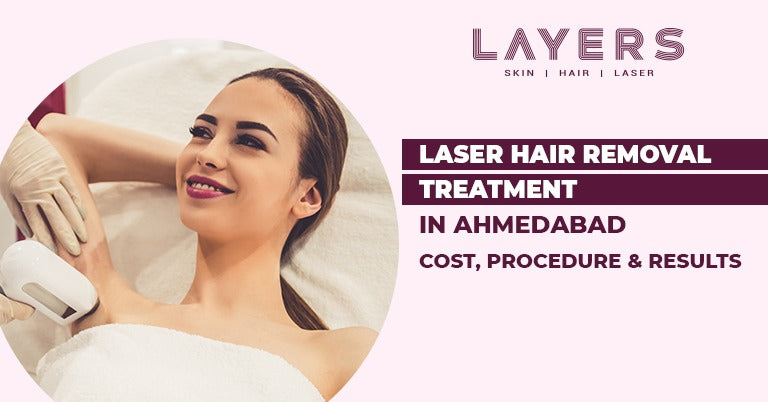 Laser hair removal treatment in Ahmedabad