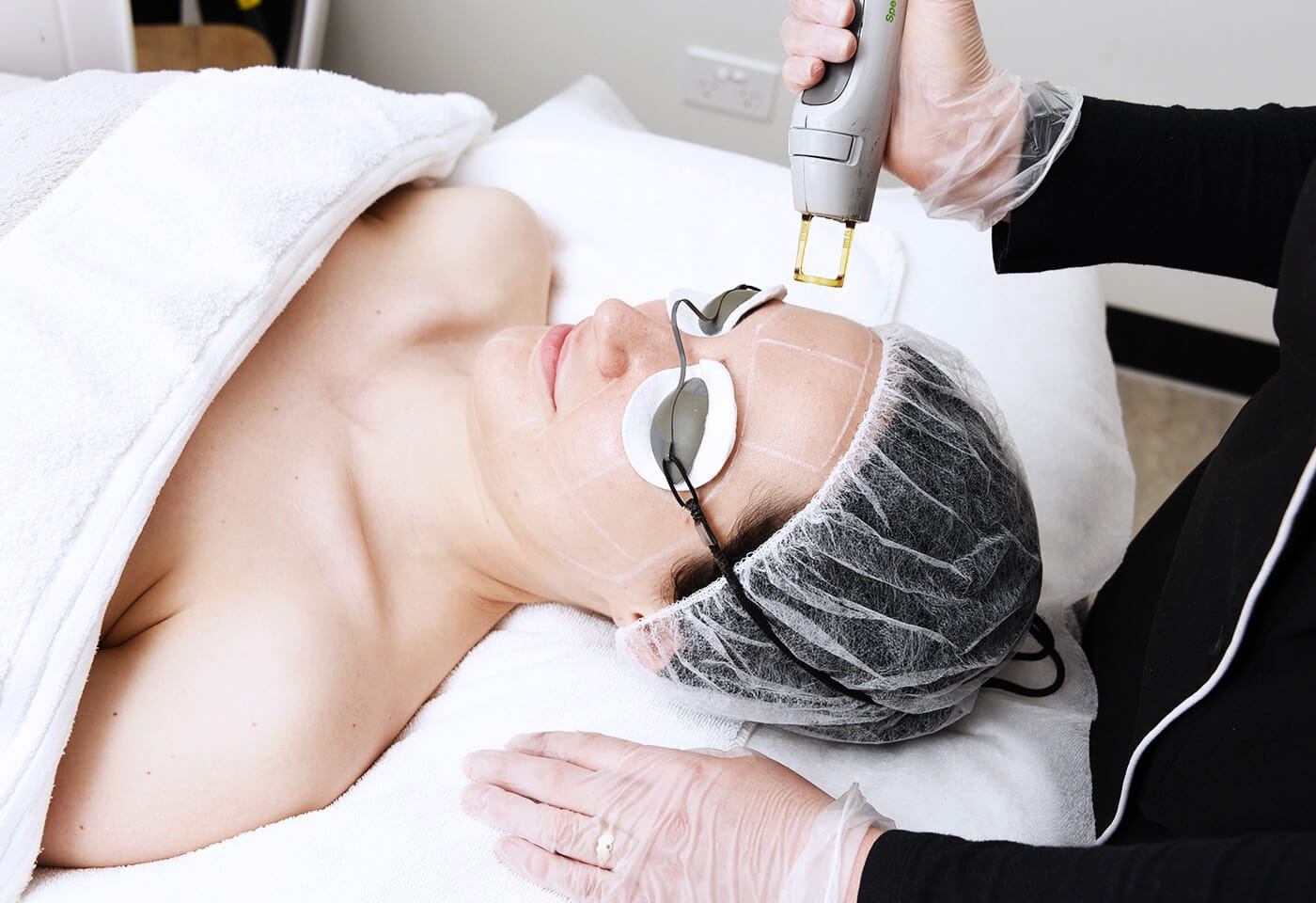 Eyebrow Laser Hair Removal - MySkin Clinics