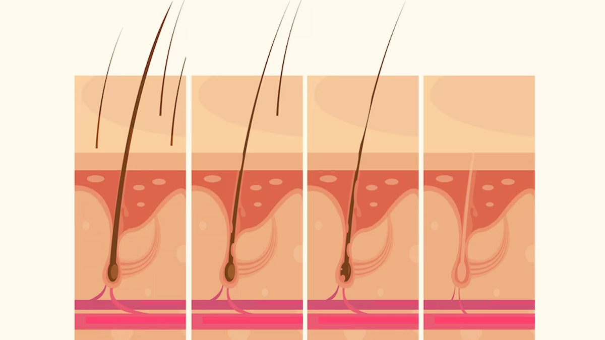 Ingrown Hair: Causes, And Treatment Options To Get Rid Of It