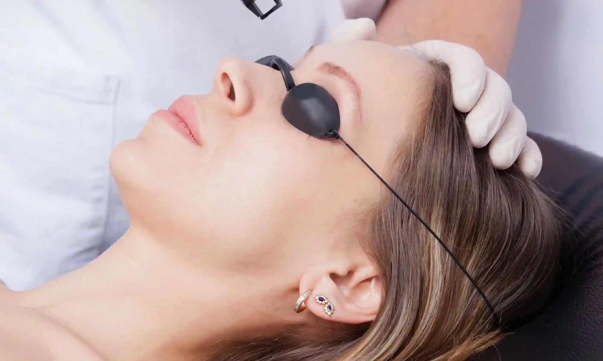 You are currently viewing EYEBROW AND UNIBROW LASER HAIR REMOVAL