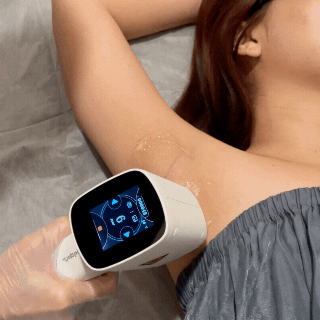 Laser Hair Removal on Underarms GIF