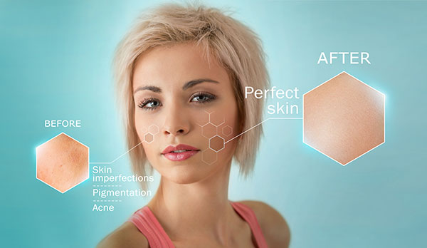 While lasers are great for improving your skin, they aren’t the right choice for every patient.