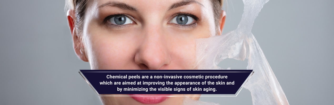 The Latest Advances in Chemical Peels