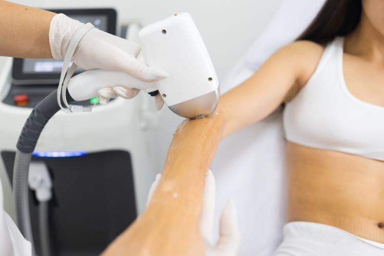 Say Goodbye To Unwanted Hair With Laser Hair Removal in Tampa