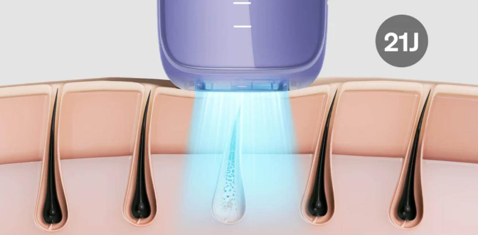 What is IPL? How Does It Work for Hair Removal?