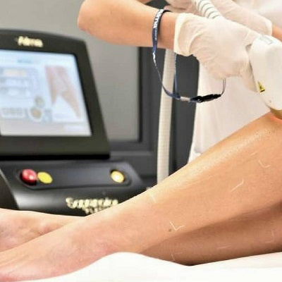 Soprano ICE Laser Price Per Session: