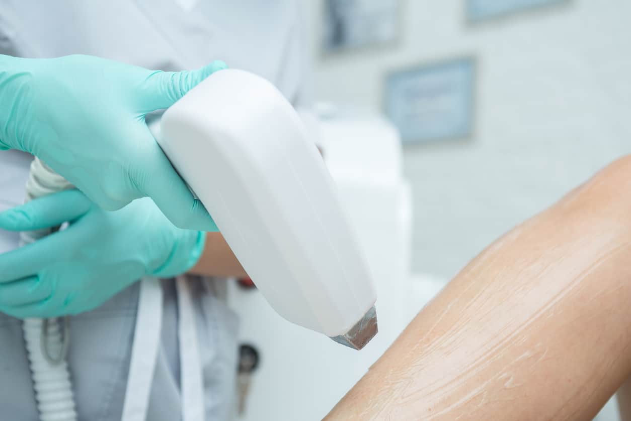 The Difference Between Intense Pulsed Light and Laser Hair Removal