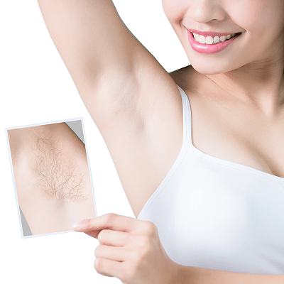 Underarm Laser Hair Removal