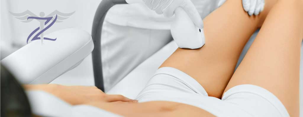 Laser Hair Removal