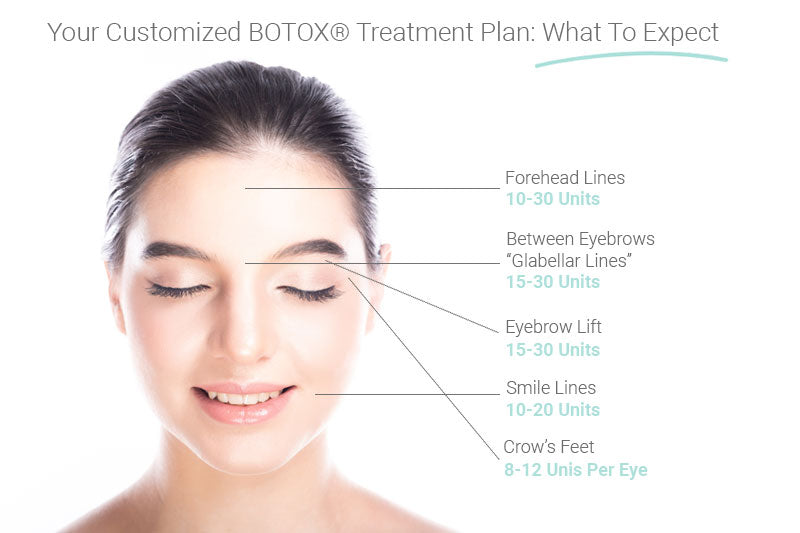 Botox Injections Fundamentals Explained