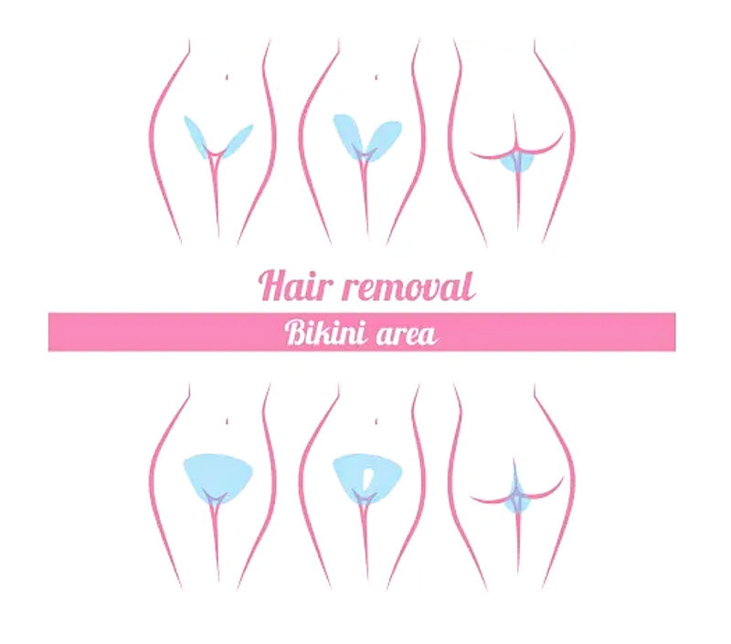 Hair Removal removal hair cream removal hair wax removal hair laser removal hair spray removal hair machine removal hair laser near me removal hair face removal hair laser machine hair removal armpit