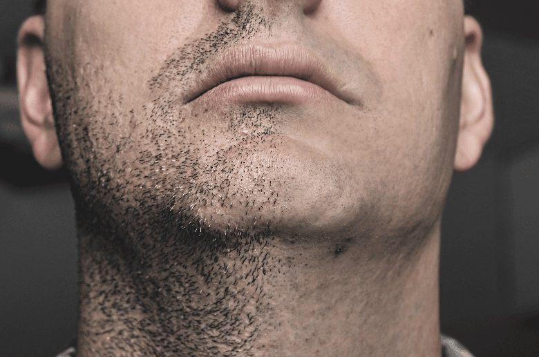 Image of mans chin with a half shaved face