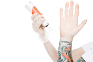 7 ‘Must Ask’ questions before being treated for Laser Tattoo Removal