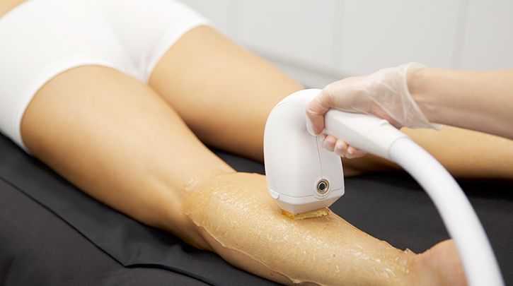 Device Spotlight: Hair Removal With Venus Velocity™ and Venus Epileve™