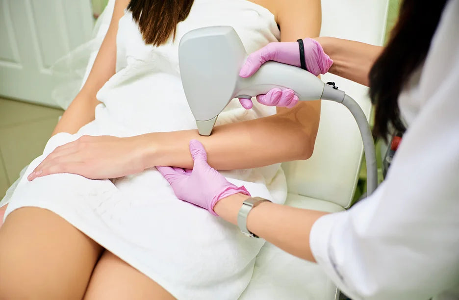 laser hair removal treatment on arm